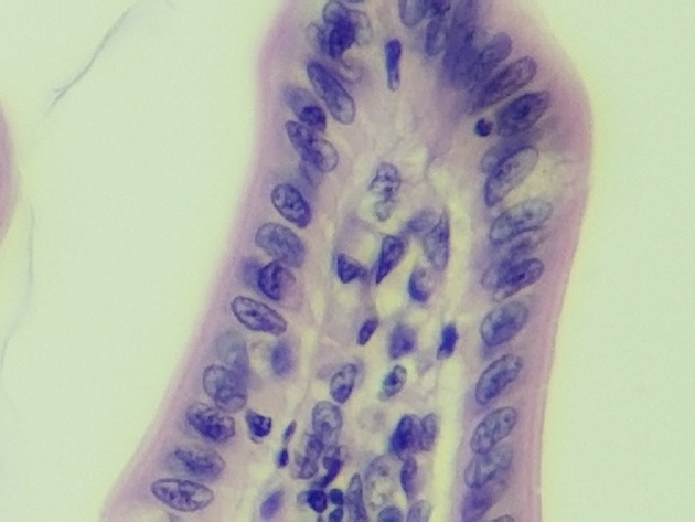 Simple Columnar Epithelium Slides - Simple Columnar Epithelium 02 400X